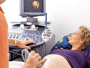 פערים בין הערכות המשקל פערים בין הערכות המשקל