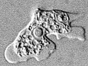 האמבה הקטלנית האמבה הקטלנית