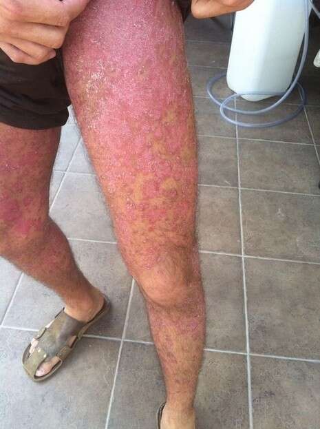 צילום: דובר איכילוב צילום: דובר איכילוב