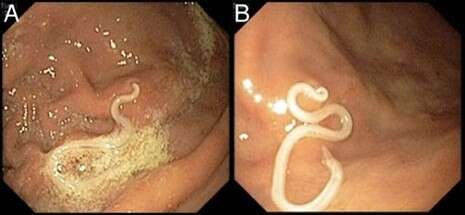 : BMJ CASE REPORTS